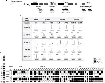 ADD3 Deletion in Glioblastoma Predicts Disease Status and Survival